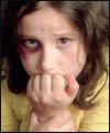 عواقب تنبیه بدنی کودکان چیست؟